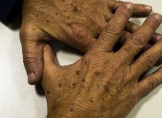 Brasil projeta 781 mil novos casos de câncer por ano até 2028 Brasil projeta 781 mil novos casos de câncer por ano até 2028