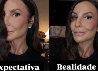 Ivete Sangalo Mostra O Rosto Nas Redes Sociais Dois Dias Após Desmaio