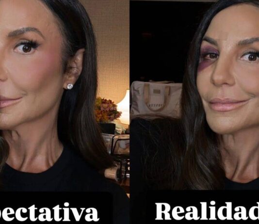 Ivete Sangalo Mostra O Rosto Nas Redes Sociais Dois Dias Após Desmaio