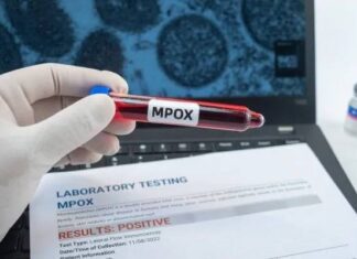 Brasil Registra 140 Casos Confirmados De Mpox Brasil Registra 140 Casos Confirmados De Mpox