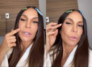 Ivete Sangalo Revela Sequelas Após Cirurgia No Rosto E Diz Sentir Dormência