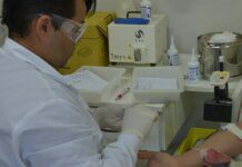 Sintomas da doença falciforme vão além da anemia; saiba mais