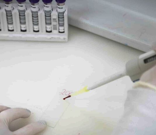 Exames descartam ebola em imigrante da República Democrática do Congo