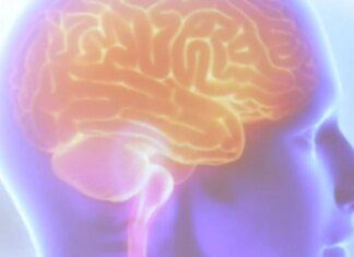 Diagnóstico precoce garante qualidade de vida na esclerose múltipla Diagnóstico precoce garante qualidade de vida na esclerose múltipla