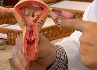Aberta chamada pública para pesquisas sobre endometriose
