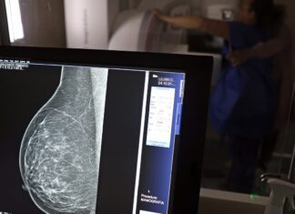 Plano de saúde terá que cobrir mamografia digital para todas as idades